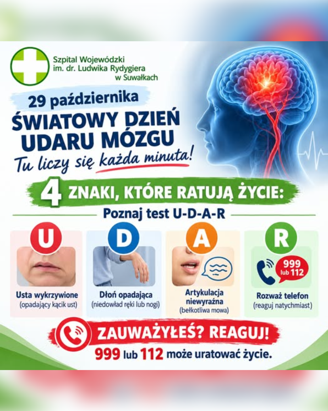 Udar mózgu nie daje czasu do namysłu. Test U-D-A-R może uratować życie Udar mózgu nie daje czasu do namysłu. Test U-D-A-R może uratować życie